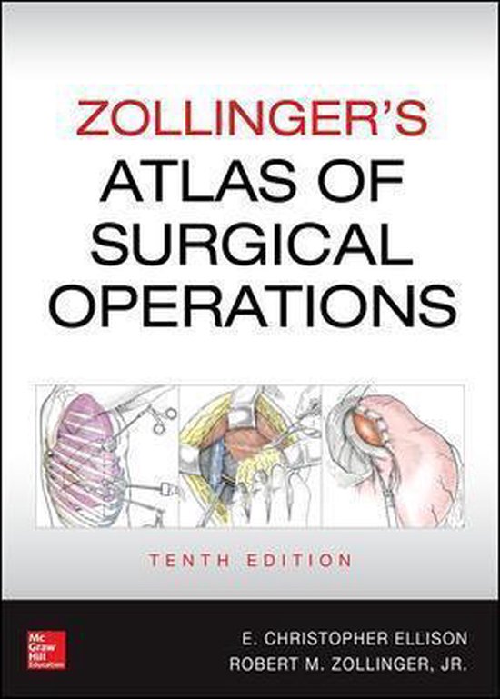 Zollinger's Atlas of Surgical Operations, Tenth Edition