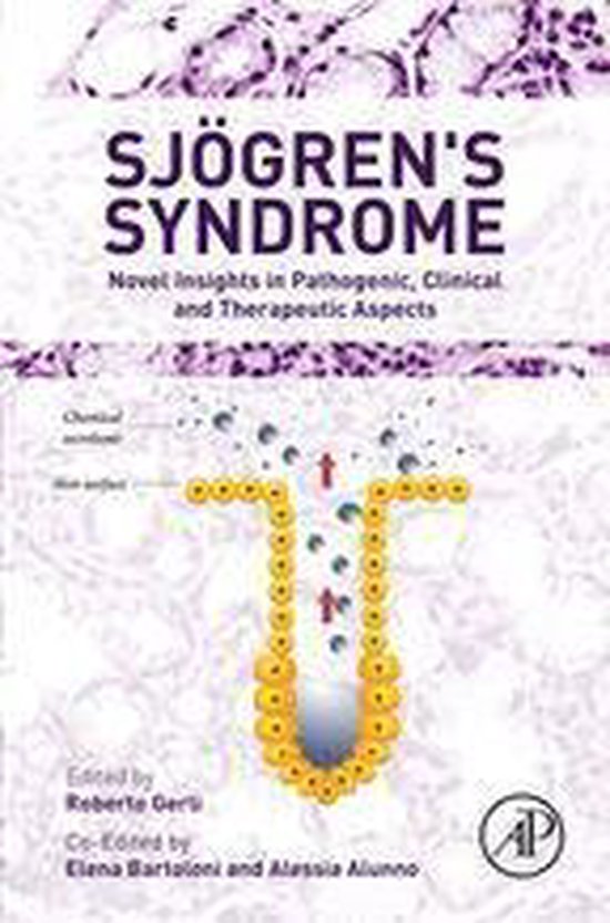 Sjogren's Syndrome