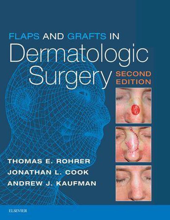 Flaps and Grafts in Dermatologic Surgery