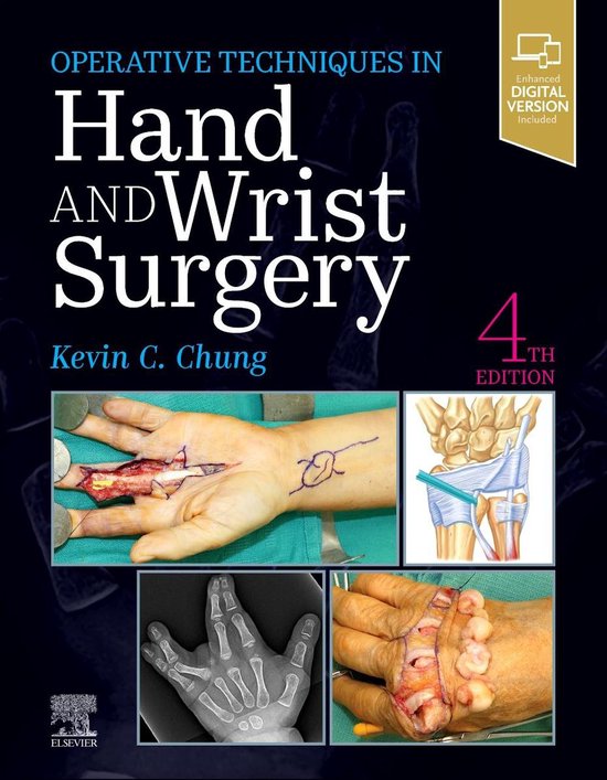 Operative Techniques: Hand and Wrist Surgery