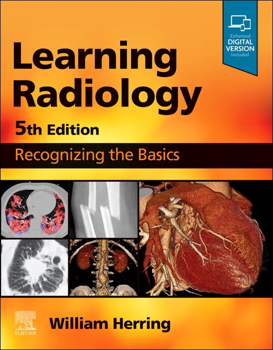 Learning Radiology