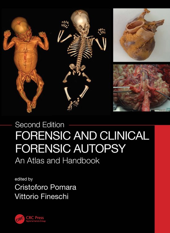 Forensic and Clinical Forensic Autopsy