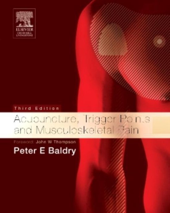 Acupuncture, Trigger Points and Musculoskeletal Pain