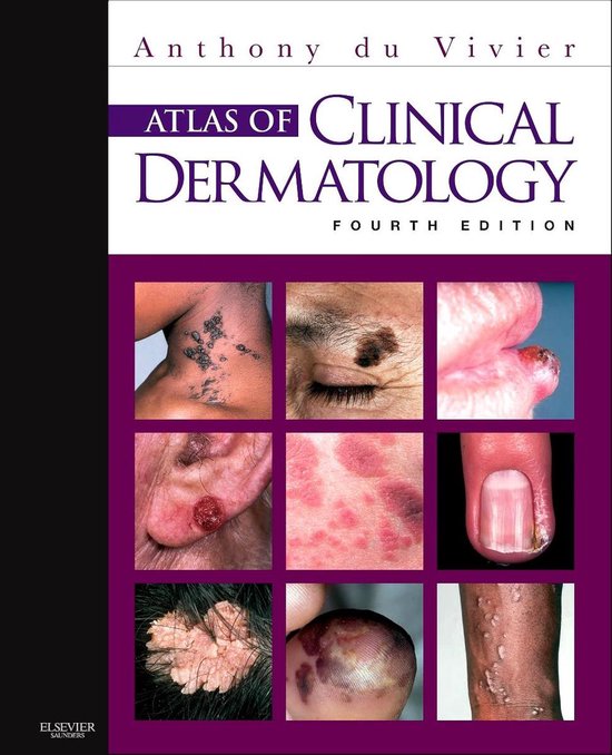 Atlas Of Clinical Dermatology