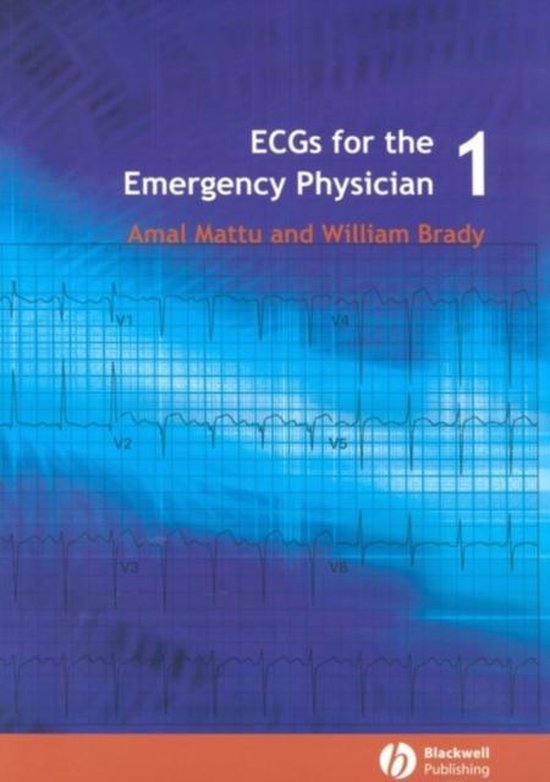 Ecgs For The Emergency Physician