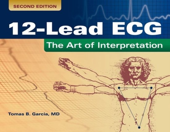 12 lead ECG