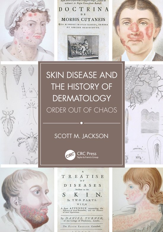 Skin Disease and the History of Dermatology