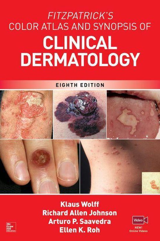 Fitzpatrick's Color Atlas and Synopsis of Clinical Dermatology, Eighth Edition