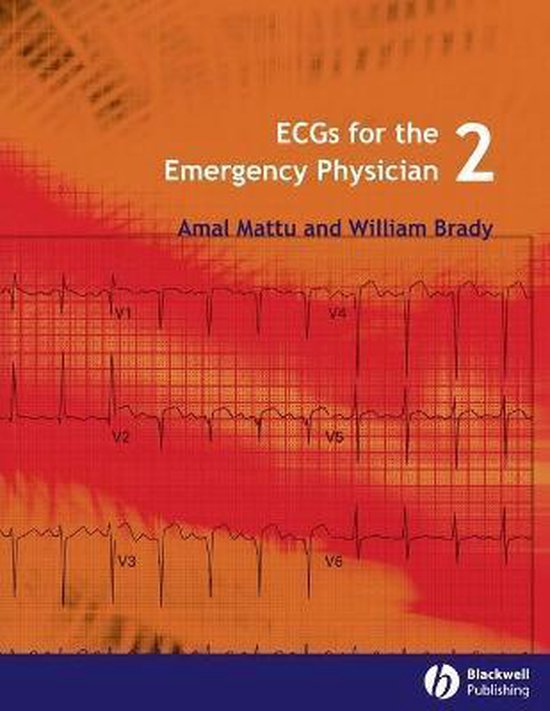 ECGs for the Emergency Physician 2