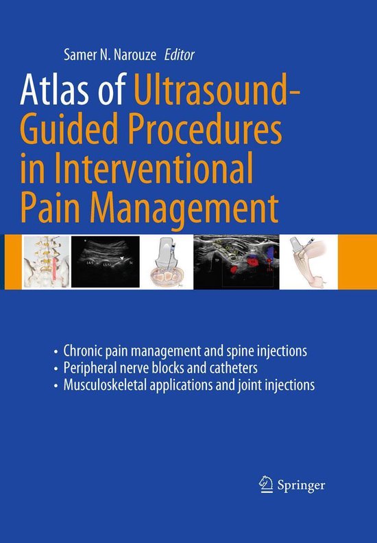 Atlas of Ultrasound-Guided Procedures in Interventional Pain Management