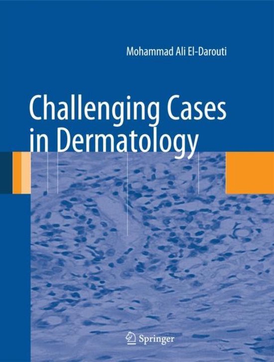 Challenging Cases in Dermatology