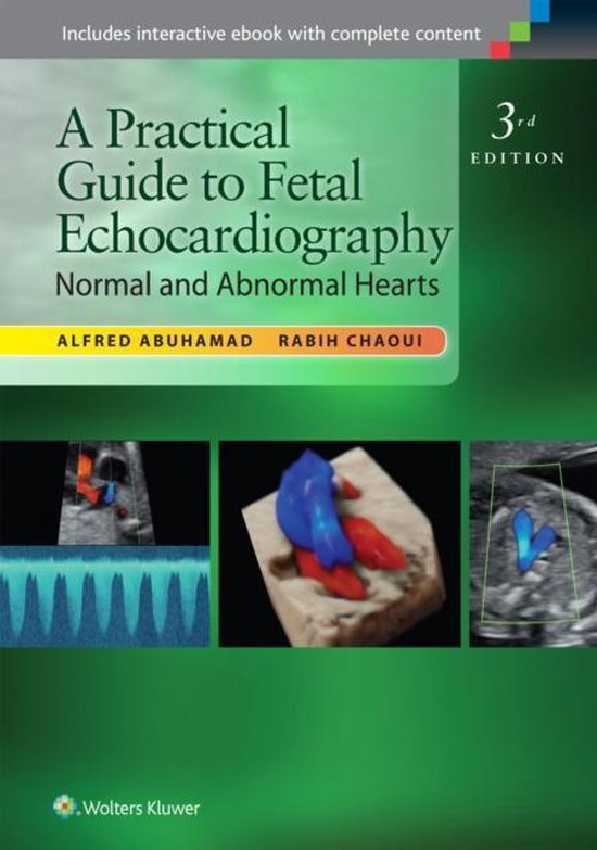 A Practical Guide to Fetal Echocardiography