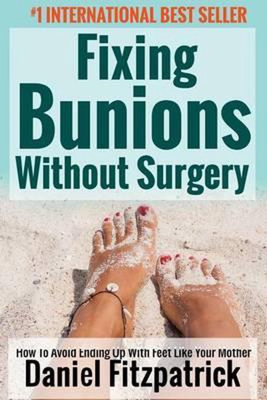 Fixing Bunions Without Surgery