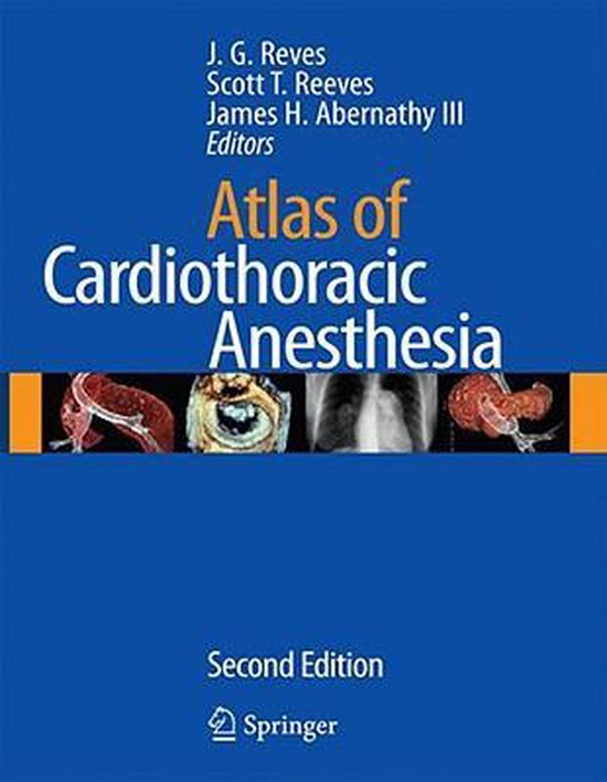 Atlas of Cardiothoracic Anesthesia