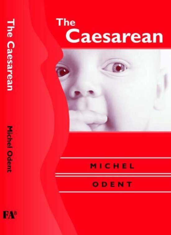 The Caesarean