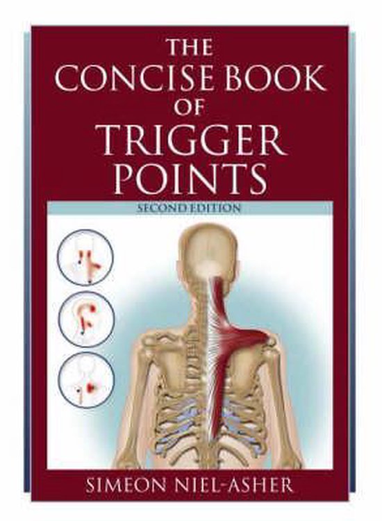 Concise Book of Trigger Points