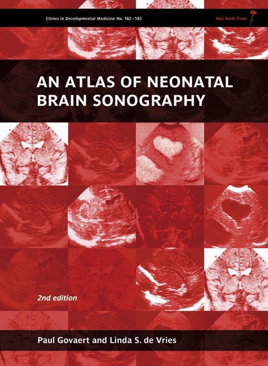 182 - An Atlas of Neonatal Brain Sonography, 2nd Edition