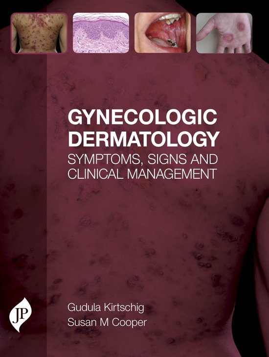 Gynecologic Dermatology