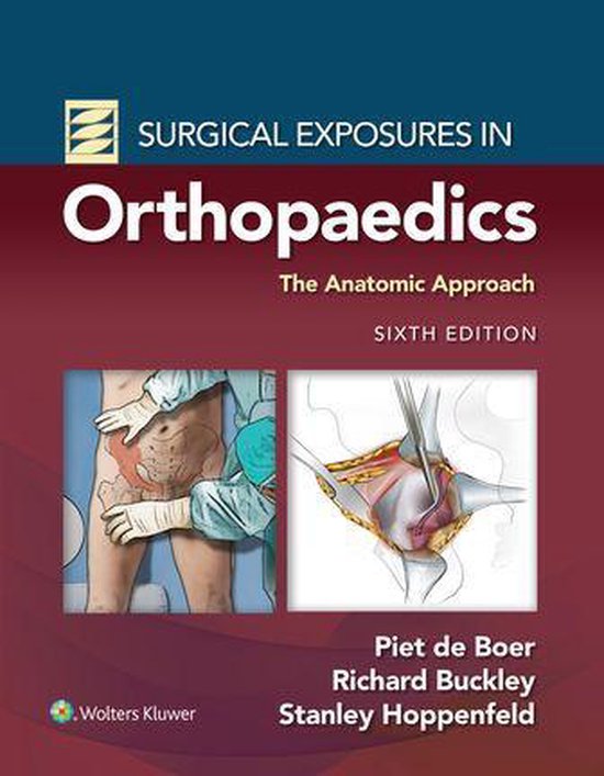 Surgical Exposures in Orthopaedics: The Anatomic Approach