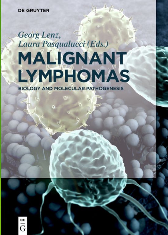 Malignant Lymphomas