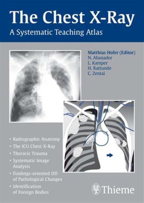 Chest X-ray Trainer