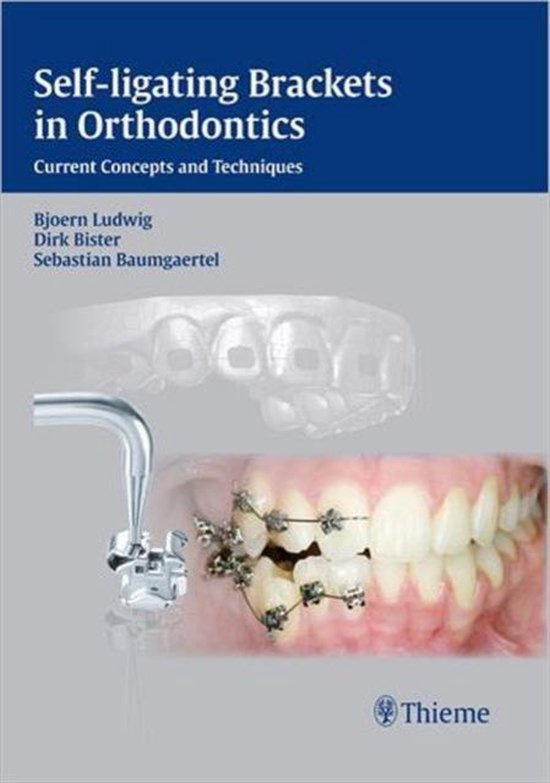 Self-Ligating Brackets In Orthodontics