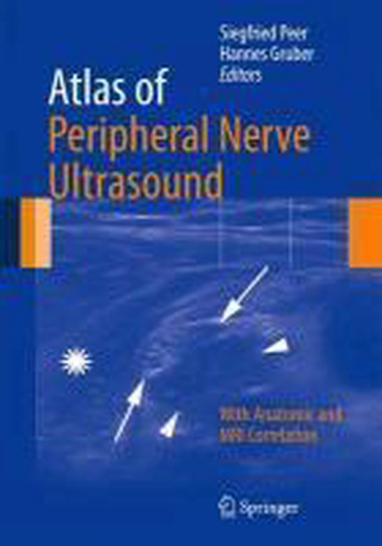 Atlas Of Peripheral Nerve Ultrasound