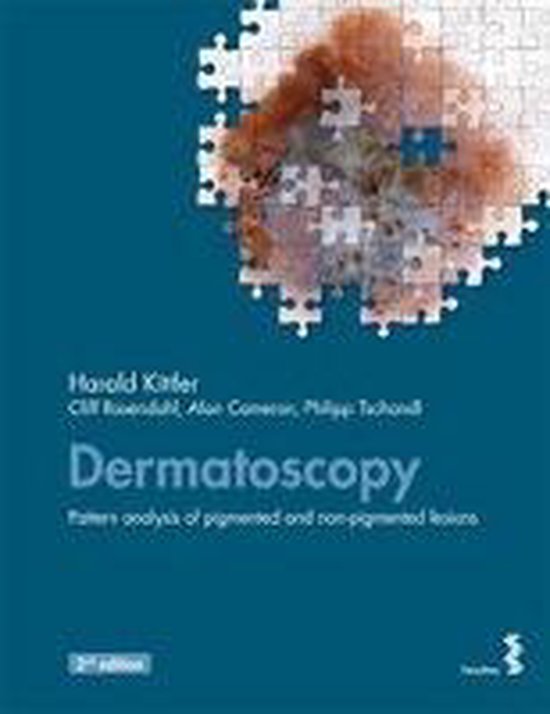 Dermatoscopy