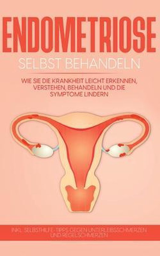 Endometriose selbst behandeln