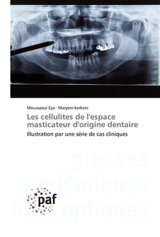 Les cellulites de l'espace masticateur d'origine dentaire