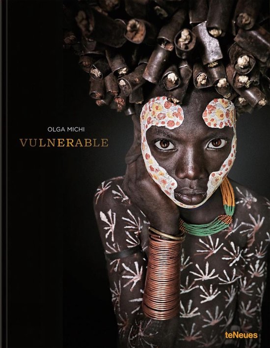 Vulnerable