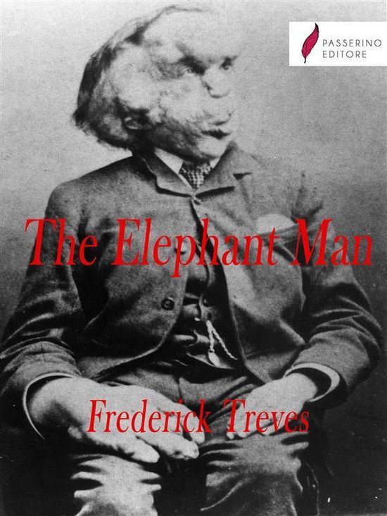 The Elephant Man