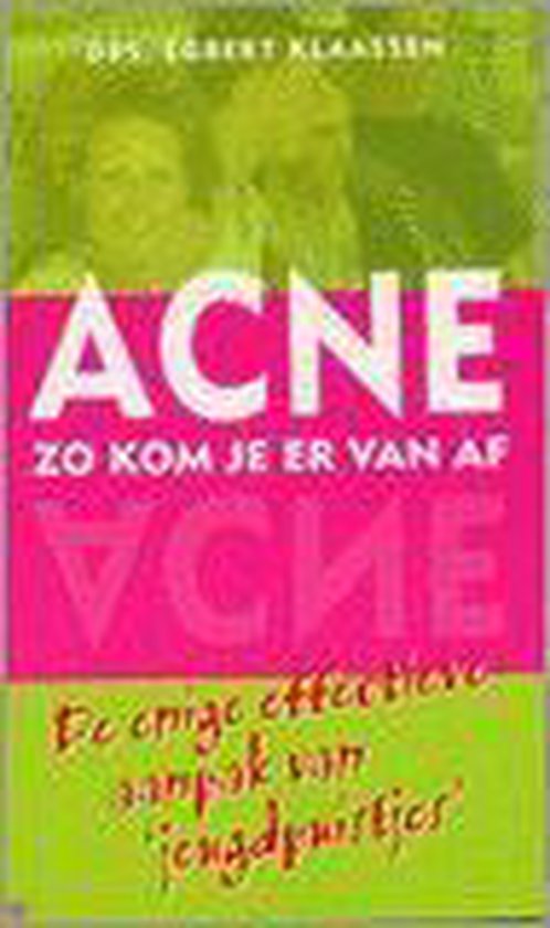 Acne Zo Kom Je Er Van Af