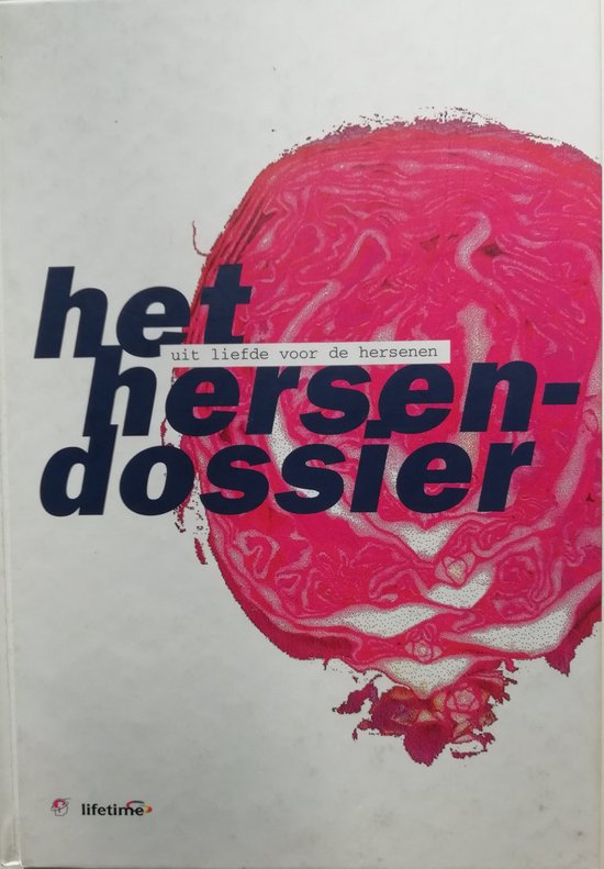 Het hersendossier