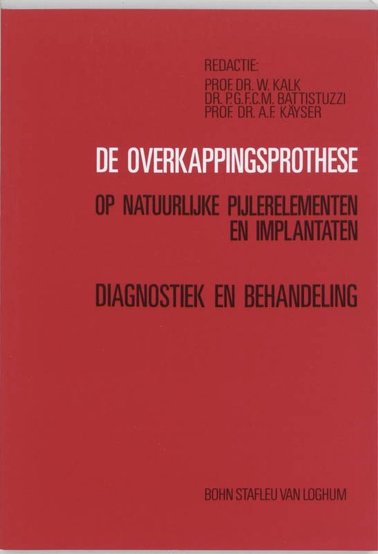 De overkappingsprothese op natuurlijke pijlerelementen en implantaten