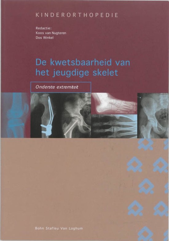 Orthopedische casuïstiek - De kwetsbaarheid van het jeugdige skelet: onderste extremiteit