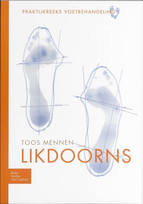 Praltijkreeks voetbehandeling - Likdoorns