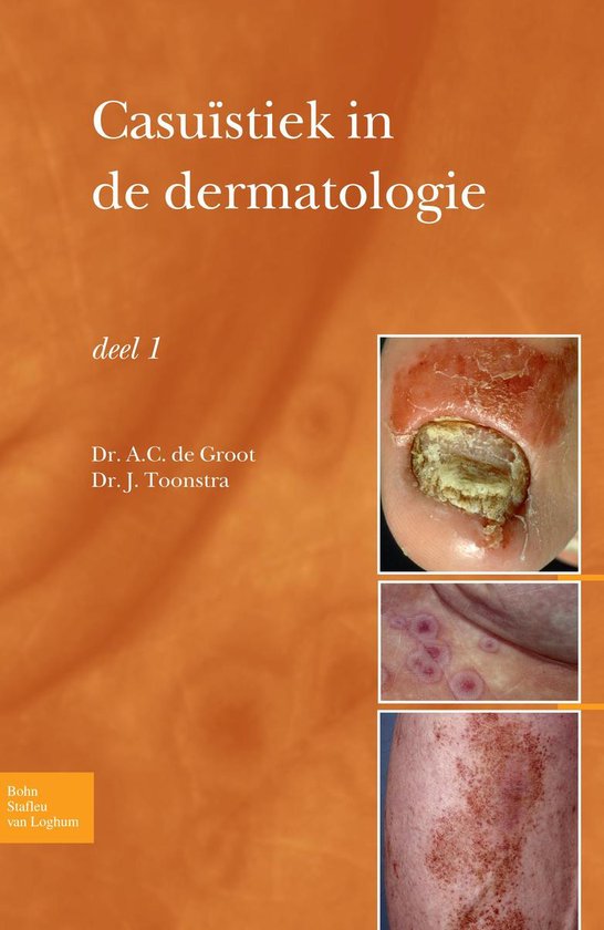 Casuïstiek in de dermatologie - deel I