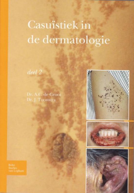 Casuïstiek in de dermatologie