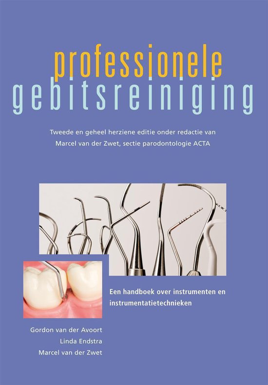 Professionele gebitsreiniging