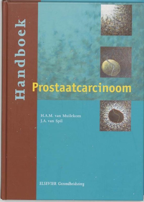 Handboek prostaatcarcinoom