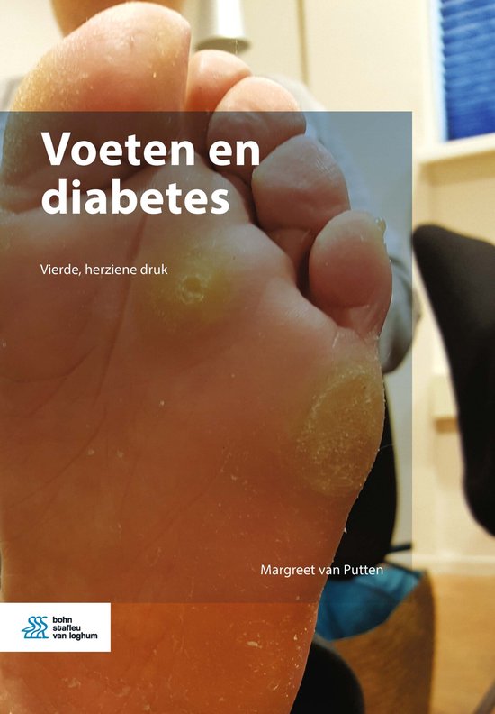 Voeten en diabetes