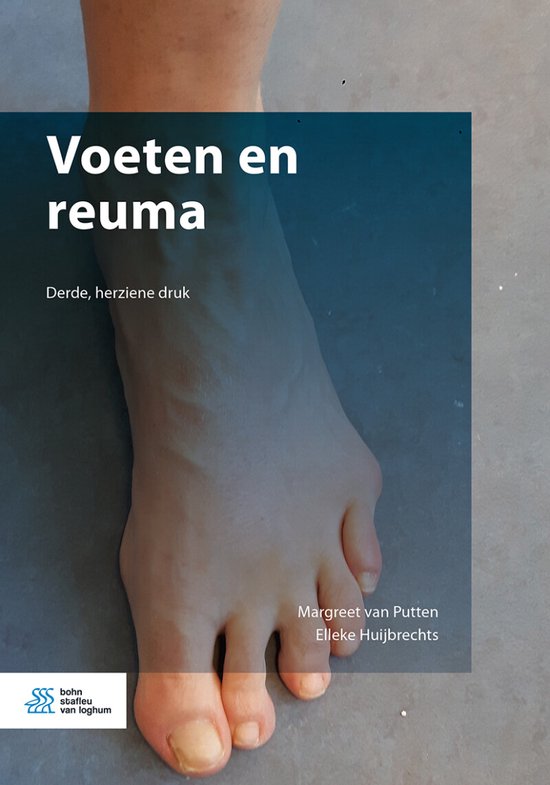 Voeten en reuma