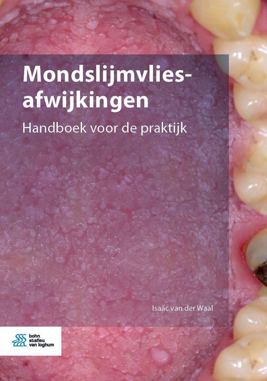 Mondslijmvliesafwijkingen