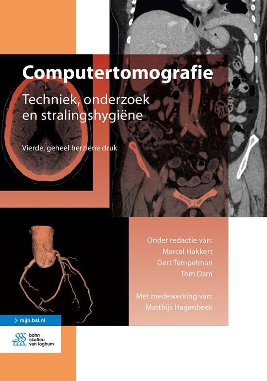 Medische beeldvorming en radiotherapie - Computertomografie