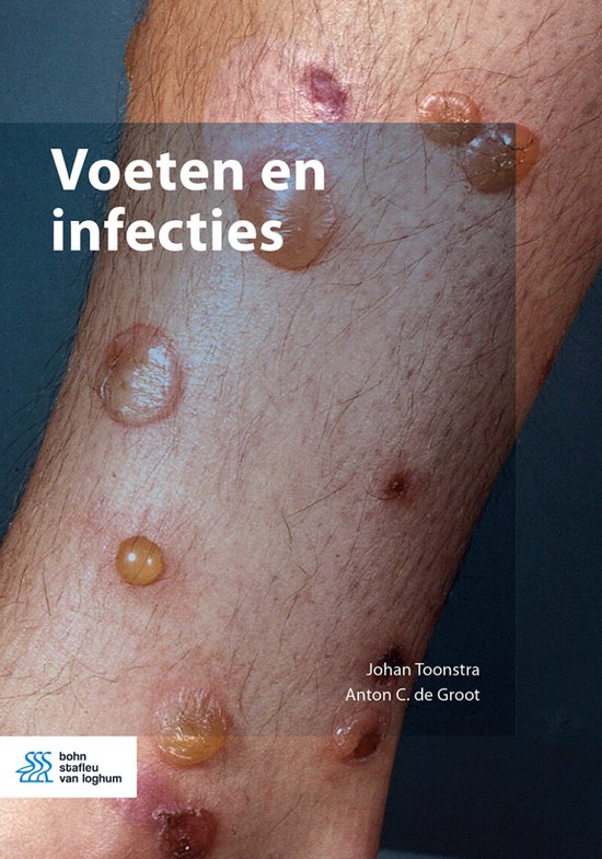 Voeten en infecties