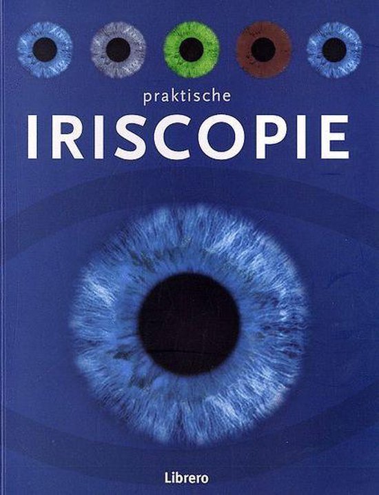 Iriscopie