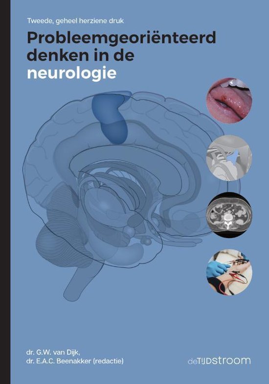 Probleemgeoriënteerd denken in de neurologie