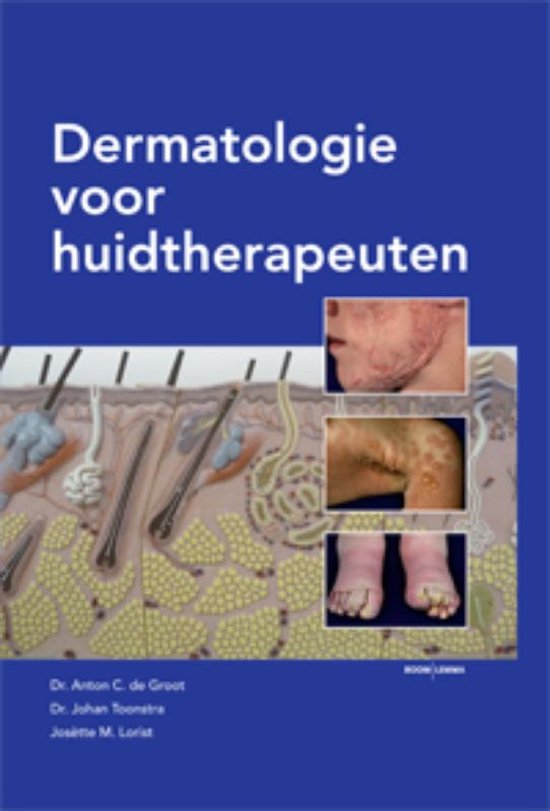 Dermatologie voor huidtherapeuten