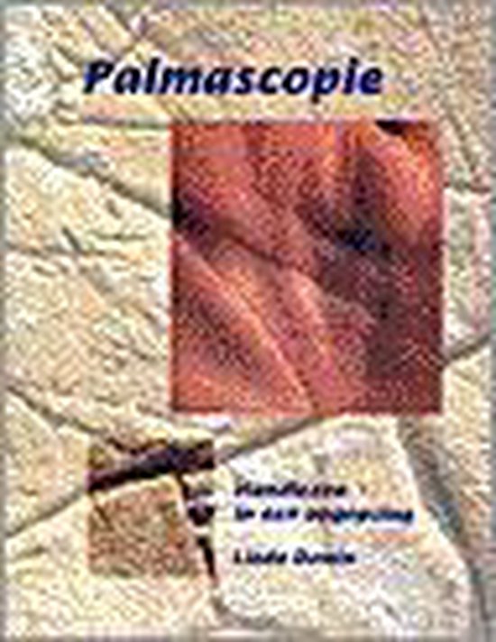 Palmascopie